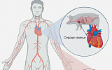 Ксенотрасплантологи «подсунули» пациенту нужный иммунитет